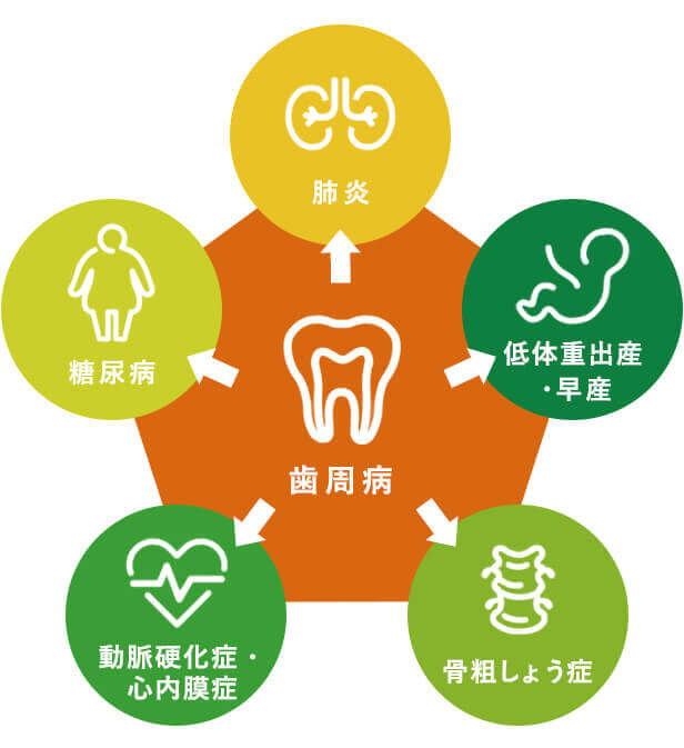 ８割の日本人が歯周病