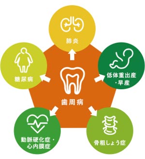 歯周病は全身の病気に影響します